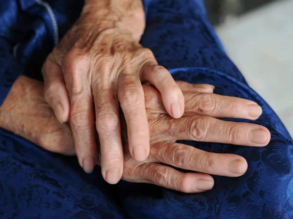 Elderly hands with marked joints, illustration of rheumatoid arthritis